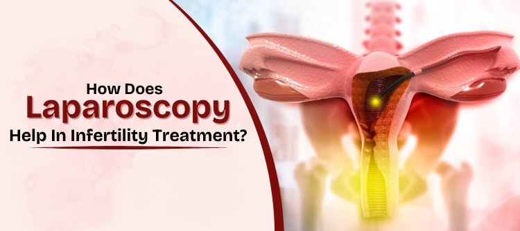 What Is Laparoscopy? Procedure, Recovery & Its Role in Fertility Treatment